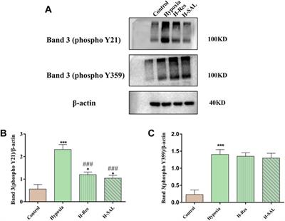 Mechanism of hypoxia-induced damage to the mechanical property in human erythrocytes—band 3 phosphorylation and sulfhydryl oxidation of membrane proteins